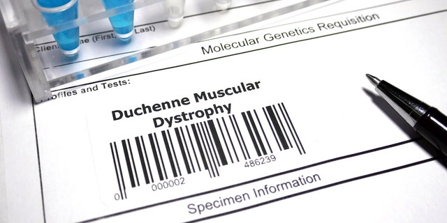 Muscular dystrophy