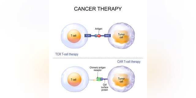 CAR T-cell therapy