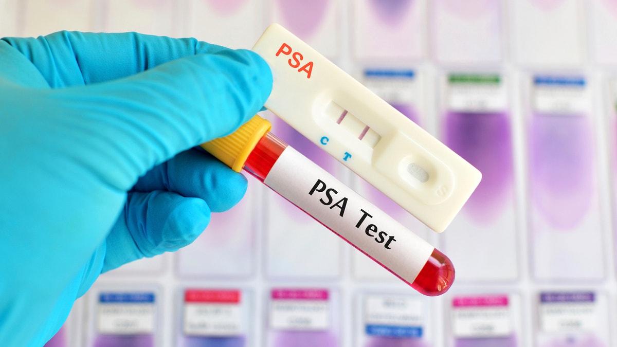 psa test prostate cancer 