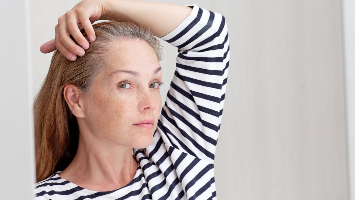 Woman thinning hair