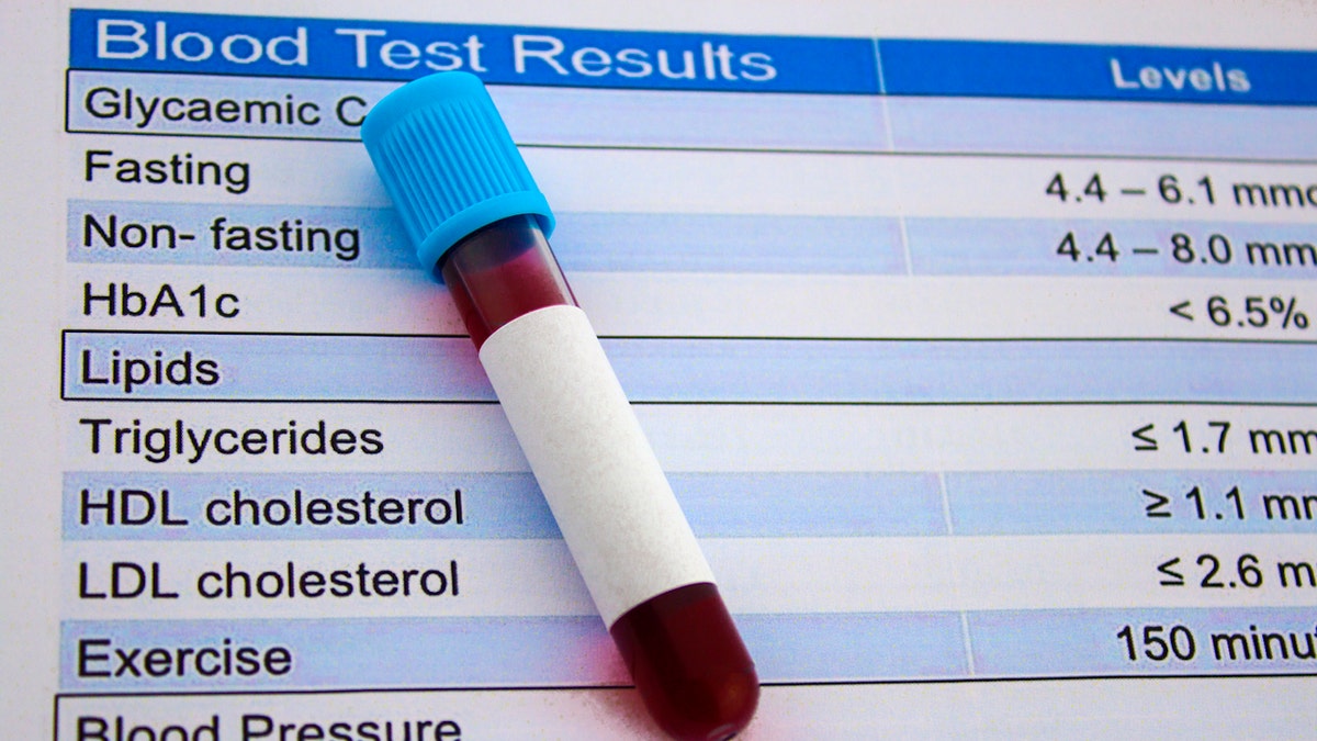 Blood test results