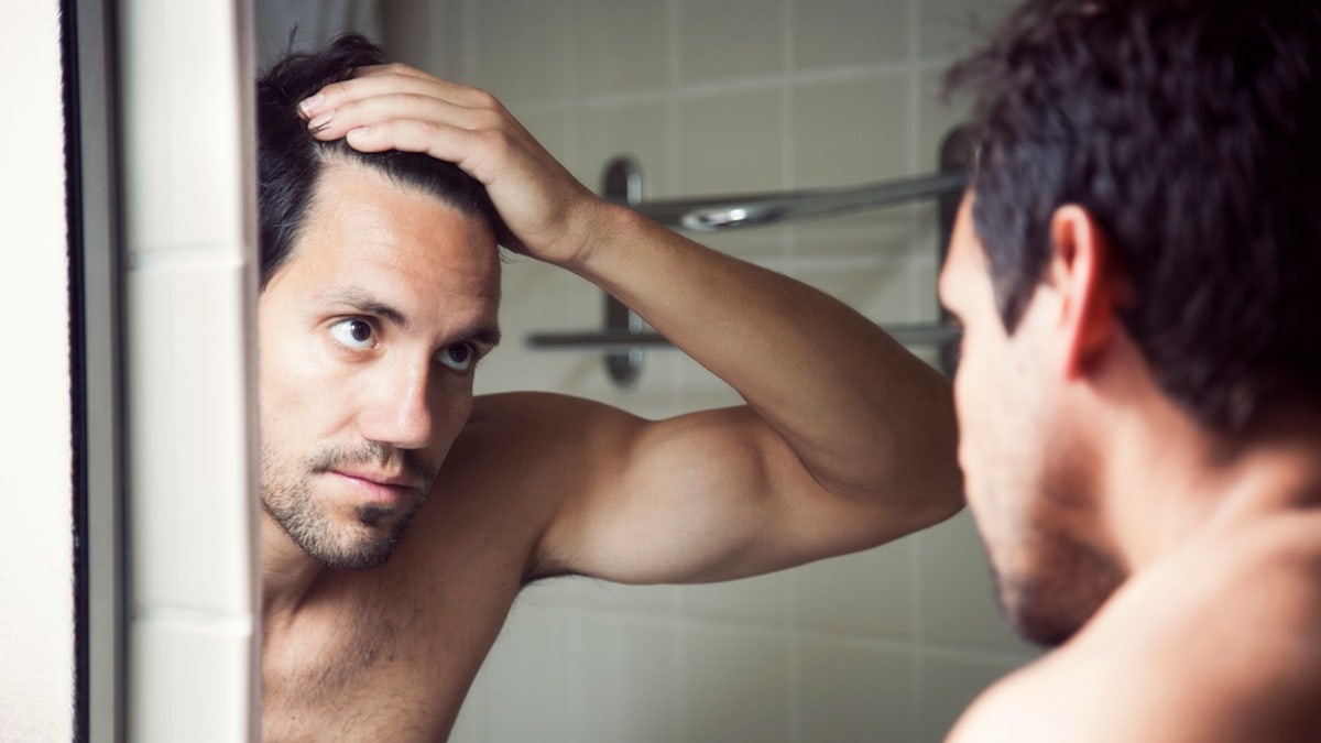 Male hair loss