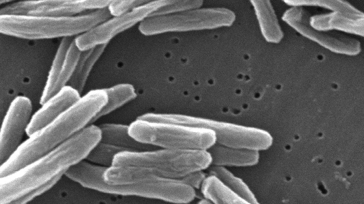 Tuberculosis bacteria